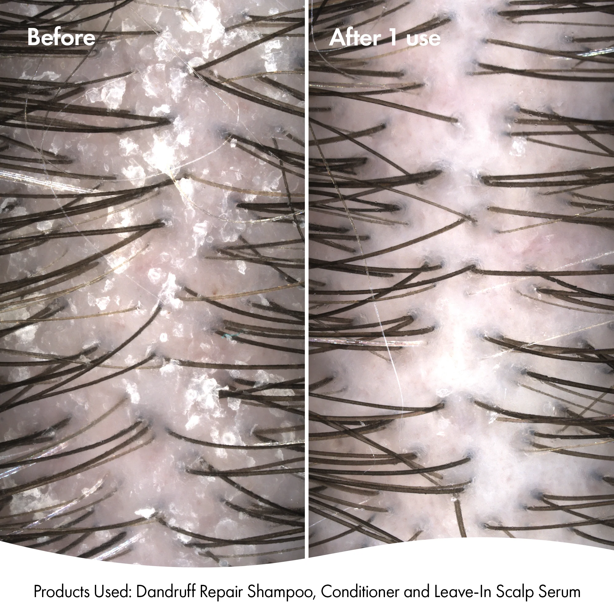 DANDRUFF SHAMPOO - Image 4