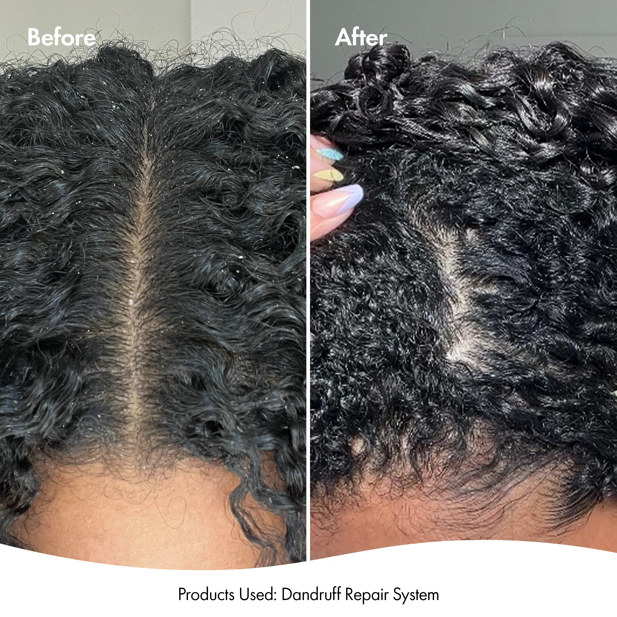 LEAVE-IN SCALP SERUM - Image 4