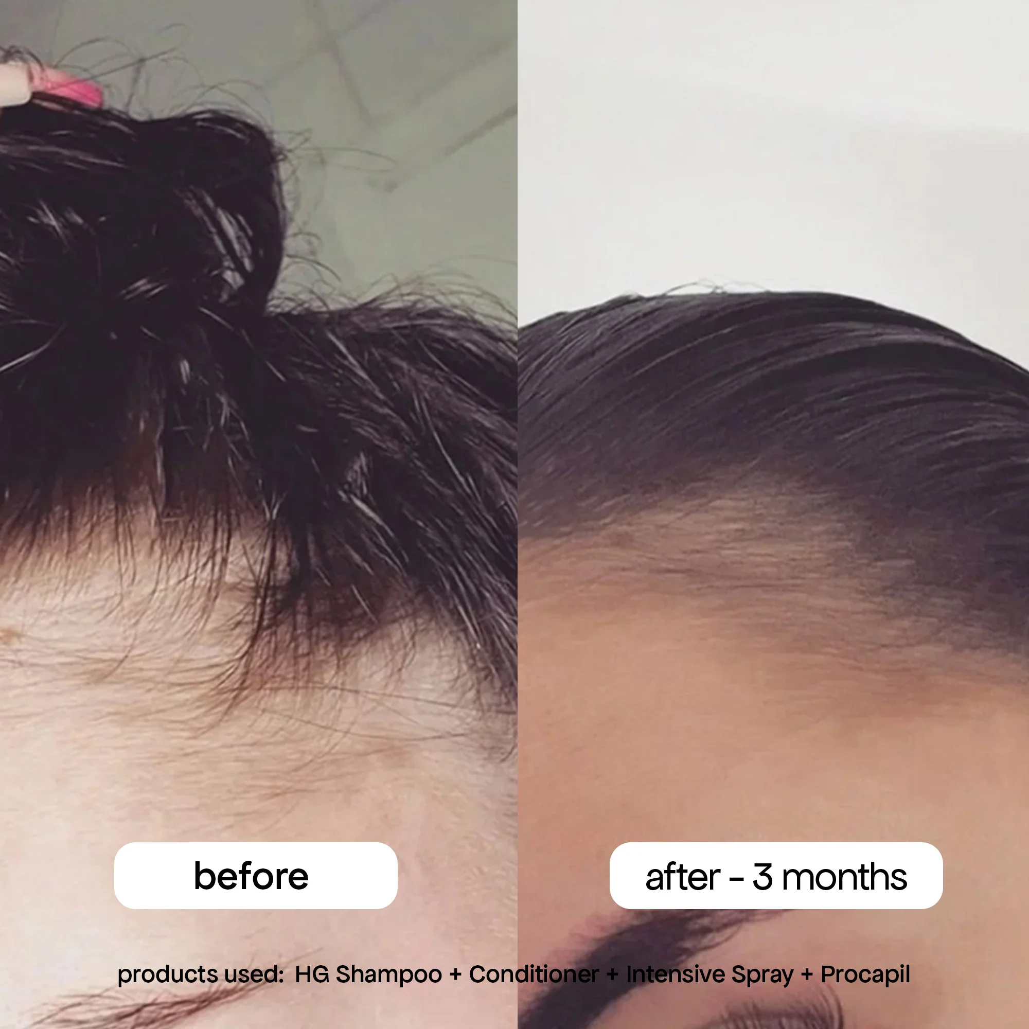ANTI-THINNING INTENSIVE SCALP SPRAY - Image 3