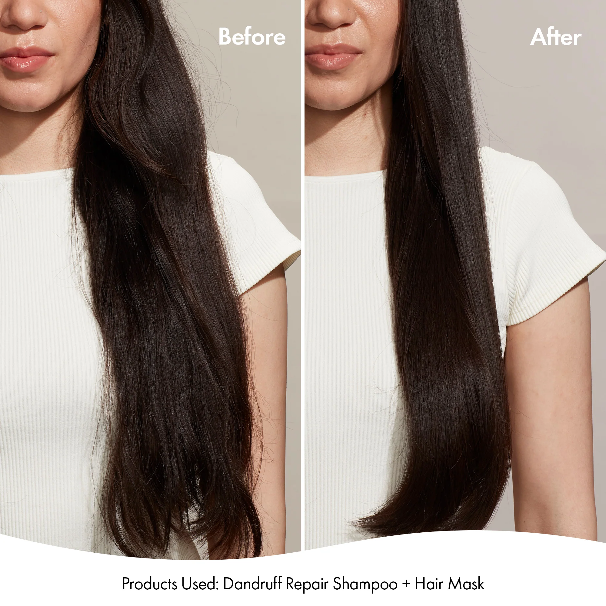 DANDRUFF SHAMPOO - Image 3