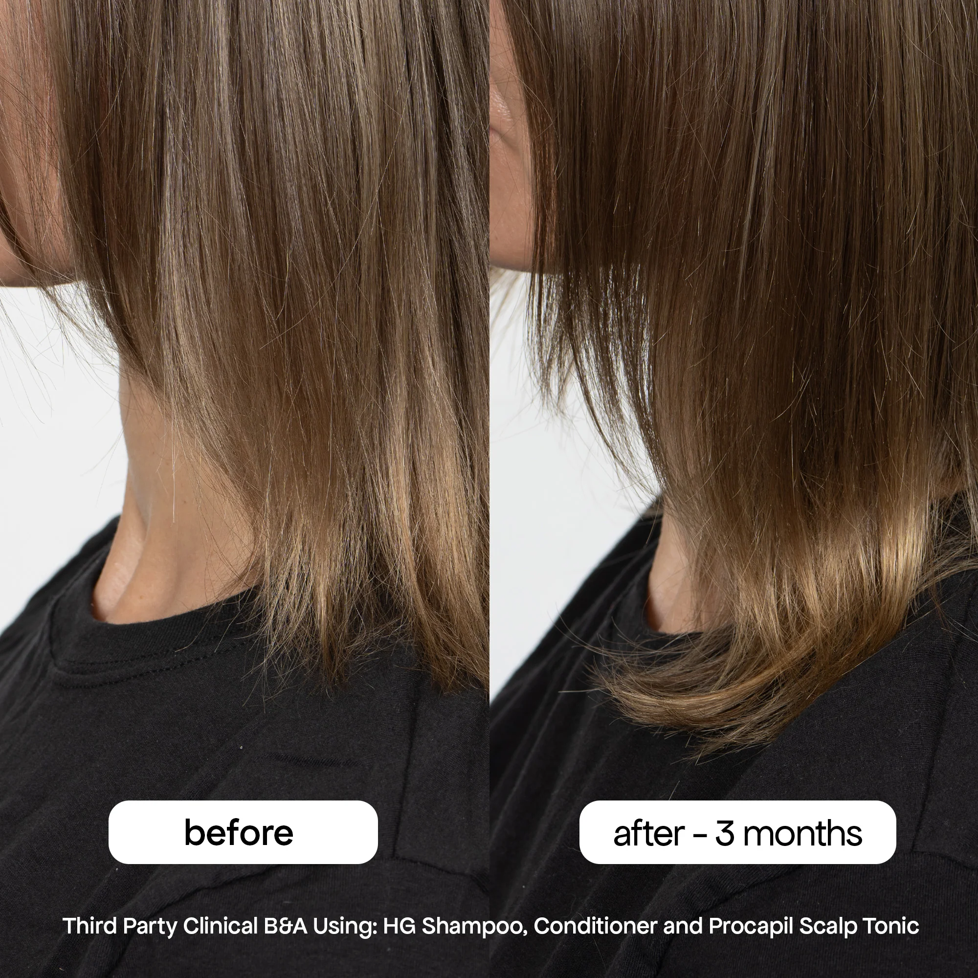 ANTI-THINNING PROCAPIL® SCALP TONIC - Image 3