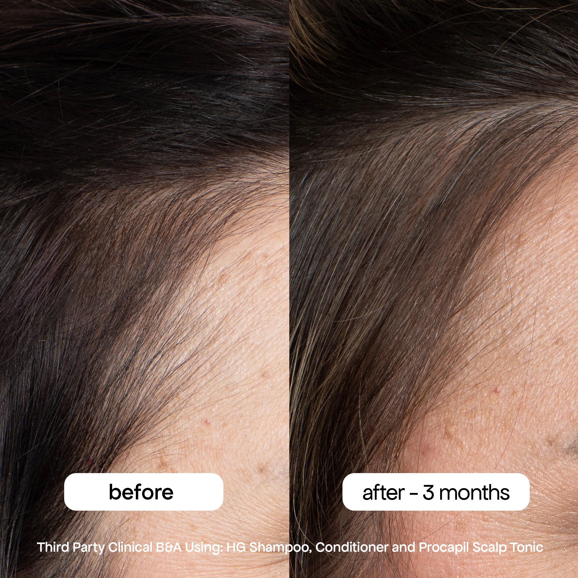ANTI-THINNING PROCAPIL® SCALP TONIC - Image 4